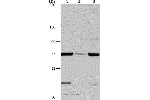 Western blot analysis of LoVo cell, human testis tissue and A549 cell, using FAAH Polyclonal Antibody at dilution of 1:400 (FAAH antibody)