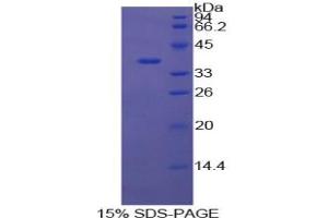 SDS-PAGE analysis of Cow Annexin V Protein. (Annexin V Protein)