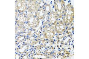Immunohistochemistry of paraffin-embedded mouse kidney using ST8SIA2 antibody.