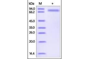 Human Serpin D1, His Tag on SDS-PAGE under reducing (R) condition. (SERPIND1 Protein (AA 20-499) (His tag))