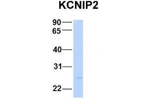 Host:  Rabbit  Target Name:  KCNIP2  Sample Type:  Human Fetal Brain  Antibody Dilution:  1. (KCNIP2 antibody  (N-Term))
