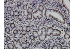 Immunoperoxidase of monoclonal antibody to MEF2A on formalin-fixed paraffin-embedded human small Intestine. (MEF2A antibody  (AA 71-170))