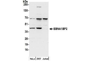 Western Blotting (WB) image for anti-EBNA1 Binding Protein 2 (EBNA1BP2) (AA 256-306) antibody (ABIN7449723)