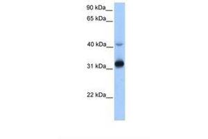 Image no. 1 for anti-Trans-2,3-Enoyl-CoA Reductase (TECR) (AA 110-159) antibody (ABIN6738459) (TECR antibody  (AA 110-159))
