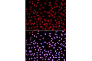 Immunofluorescence analysis of U2OS cells using POLH antibody (ABIN5970934). (POLH antibody)