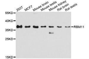 Western blot analysis of extracts of various cell lines, using RBM11 antibody. (RBM11 antibody)