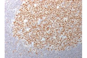 Formalin-fixed, paraffin-embedded human Tonsil stained with BCL-6 Mouse Monoclonal Antibody (BCL6/1982). (BCL6 antibody  (AA 256-389))