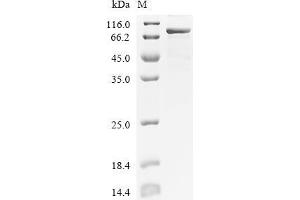 (Tris-Glycine gel) Discontinuous SDS-PAGE (reduced) with 5 % enrichment gel and 15 % separation gel.