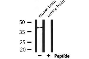 LPAR6 antibody  (Internal Region)