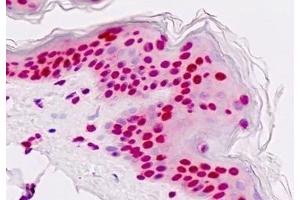 Human Skin, Epidermis: Formalin-Fixed, Paraffin-Embedded (FFPE)