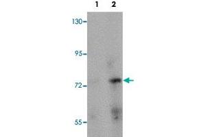 Western blot analysis of rat brain tissue with PIAS2 polyclonal antibody  at (Lane 1) 1 and (Lane 2) 2 ug/mL dilution.