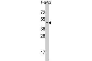 Western blot analysis of SNX6 polyclonal antibody  in HepG2 cell line lysates (35 ug/lane). (SNX6 antibody  (N-Term))