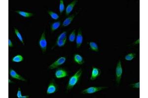 Immunofluorescent analysis of Hela cells using ABIN7174788 at dilution of 1:100 and Alexa Fluor 488-congugated AffiniPure Goat Anti-Rabbit IgG(H+L) (C1ORF189 antibody  (AA 1-101))