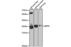 Western blot analysis of extracts of various cell lines, using SIRT4 antibody (ABIN2559931) at 1:1000 dilution.