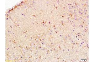 Formalin-fixed and paraffin embedded: rat brain tissue labeled with Anti-EAAT1/GLAST Polyclonal Antibody , Unconjugated at 1:200, followed by conjugation to the secondary antibody and DAB staining (SLC1A3 antibody  (AA 301-400))