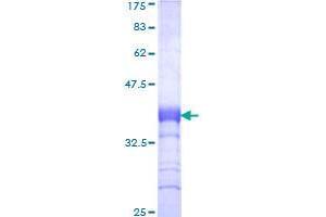 LDLR Protein (AA 105-205) (GST tag)