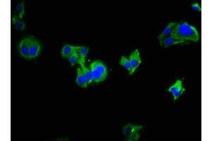 Immunofluorescence staining of HepG2 cells with ABIN7158146 at 1:333, counter-stained with DAPI. (LRRC19 antibody  (AA 25-270))