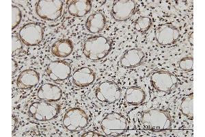 Immunoperoxidase of monoclonal antibody to QARS on formalin-fixed paraffin-embedded human colon. (QARS antibody  (AA 677-775))