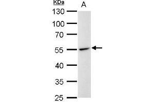 WB Image Desmin antibody detects Desmin protein by western blot analysis. (Desmin antibody)