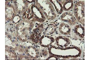 Image no. 3 for anti-Ubiquitin-Conjugating Enzyme E2, J1, U (UBE2J1) antibody (ABIN1501637)