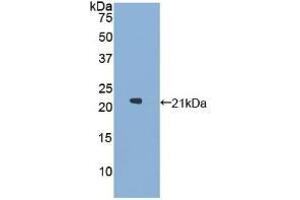 WB of Protein Standard: different control antibodies against Highly purified E. (GAA ELISA Kit)