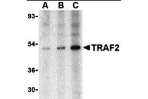 Western Blotting (WB) image for anti-TNF Receptor-Associated Factor 2 (TRAF2) (N-Term) antibody (ABIN1031639) (TRAF2 antibody  (N-Term))