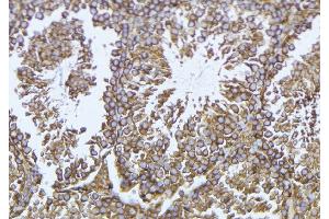 ABIN6276930 at 1/100 staining Mouse testis tissue by IHC-P. (GLB1 antibody  (Internal Region))