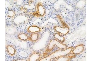 ABIN6256521 and ABIN6267628 at 1/100 staining human normal kidney tissue by IHC-P. (FOXO1 antibody  (pan, pThr24, pThr32))