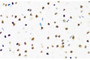 Immunohistochemistry of paraffin-embedded Mouse brain using SET Polyclonal Antibody at dilution of 1:100 (40x lens). (SET/TAF-I antibody)