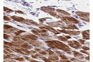 ABIN6266734 at 1/100 staining human skeletal muscle tissue sections by IHC-P. (Adenylate Kinase 1 antibody  (Internal Region))