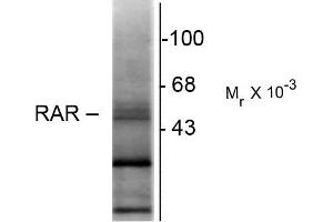 Western blots of hippocampal lysate showing specific immunolabeling of the ~48k RAR-ß isotype. (Retinoic Acid Receptor beta antibody  (N-Term))