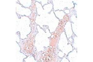 Immunohistochemical staining of rat lung tissue with REEP2 polyclonal antibody  at 5 ug/mL dilution.