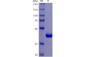 SDS-PAGE (SDS) image for Tumor Necrosis Factor Receptor Superfamily, Member 10b (TNFRSF10B) (AA 56-186) protein (mFc Tag) (ABIN6961152)