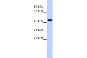 Western Blot showing TRAF1 antibody used at a concentration of 1-2 ug/ml to detect its target protein. (TRAF1 antibody  (Middle Region))