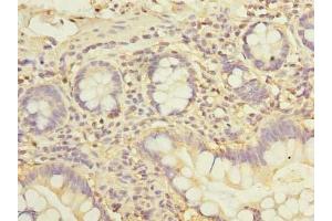 Immunohistochemistry of paraffin-embedded human small intestine tissue using ABIN7162542 at dilution of 1:100 (ZDHHC2 antibody  (AA 230-367))
