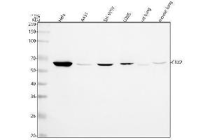 Western blot analysis of CBX2 using anti-CBX2 antibody (ABIN7604260).