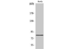 Western Blotting (WB) image for anti-Radixin (RDX) (Internal Region) antibody (ABIN3186666) (Radixin antibody  (Internal Region))