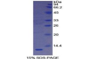 SDS-PAGE (SDS) image for Vitronectin (VTN) (AA 19-111) protein (His tag) (ABIN1081179)