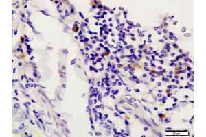 Formalin-fixed and paraffin embedded rat uterus labeled with Anti-STAT6 Polyclonal Antibody, Unconjugated (ABIN738291) at 1:200 followed by conjugation to the secondary antibody and DAB staining. (STAT6 antibody  (AA 601-700))