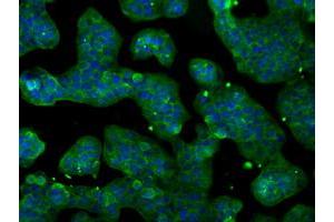 Anti-POR mouse monoclonal antibody (ABIN2453490) immunofluorescent staining of COS7 cells transiently transfected by pCMV6-ENTRY POR (RC202172). (POR antibody)