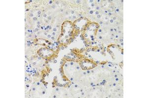 Immunohistochemistry of paraffin-embedded rat kidney using SH2B1 Antibody (ABIN1876744) at dilution of 1:100 (40x lens). (SH2B1 antibody)