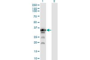Western Blot analysis of APTX expression in transfected 293T cell line by APTX monoclonal antibody (M02), clone 2H6. (Aprataxin antibody  (AA 69-166))