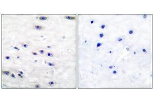 Immunohistochemistry (IHC) image for anti-Tyrosine Hydroxylase (TH) (Ser19) antibody (ABIN1847900) (Tyrosine Hydroxylase antibody  (Ser19))