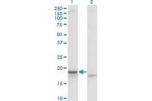 Western Blot analysis of CRH expression in transfected 293T cell line by CRH monoclonal antibody (M02), clone 2B11. (CRH antibody  (AA 154-196))