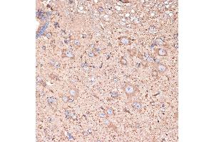 Immunohistochemistry of paraffin-embedded mouse spinal cord using GABA transaminase (GABA transaminase (ABAT)) Rabbit mAb (ABIN7265336) at dilution of 1:100 (40x lens). (ABAT antibody)