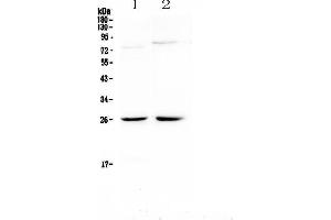 Western blot analysis of NMU using anti-NMU antibody . (Neuromedin U antibody)