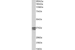 ABIN5539506 (0. (TNNT1 antibody  (Internal Region))