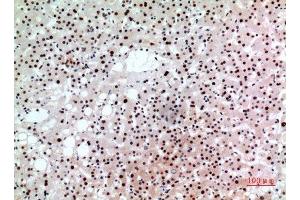 Immunohistochemistry (IHC) analysis of paraffin-embedded Human Liver, antibody was diluted at 1:100. (BCL6 antibody  (Internal Region))