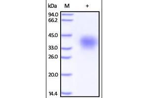 SDS-PAGE (SDS) image for Tumor Necrosis Factor Receptor Superfamily, Member 10d, Decoy with Truncated Death Domain (TNFRSF10D) (AA 56-211) protein (His tag) (ABIN2181845)