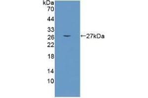 Detection of recombinant CRAT using Polyclonal Antibody to Carnitine Acetyltransferase (CRAT) (CRAT antibody  (AA 55-256))